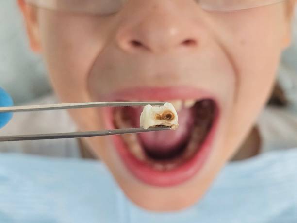Best After-Hours Emergency Dentist in Privateer, SC